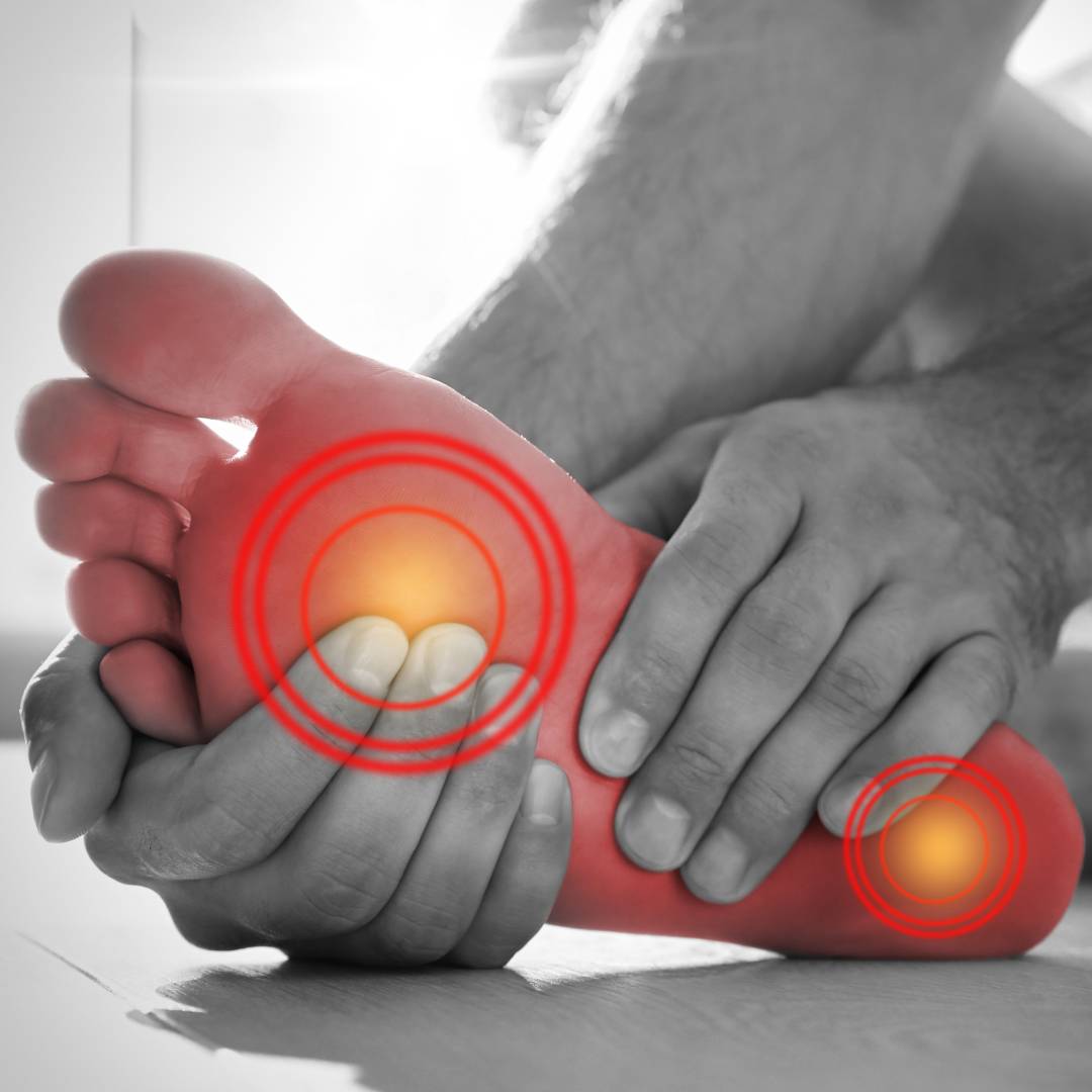 Närbild på en person som håller sin fot med smärta under trampdynan och hälen. Bilden visar röda markeringar vid belastningspunkterna och används för att illustrera fotsmärta som kan lindras med ergonomiska skoinlägg från Nordic Rehab.