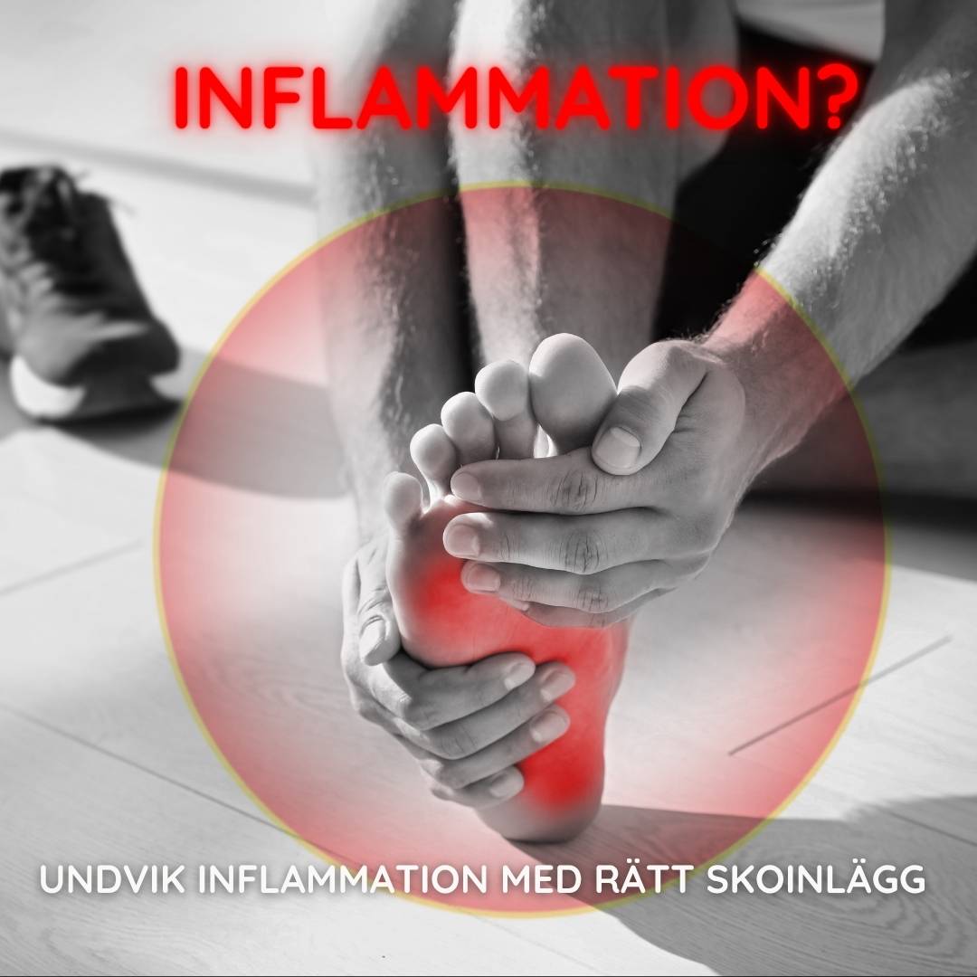 Bild från Nordic Rehab med texten ”Inflammation? Undvik inflammation med rätt skoinlägg”. En person håller sin fot med röda markeringar under trampdynan som visar irritation och belastning. Bilden används för att lyfta vikten av ergonomiska skoinlägg för att förebygga smärta och inflammation i fötterna.